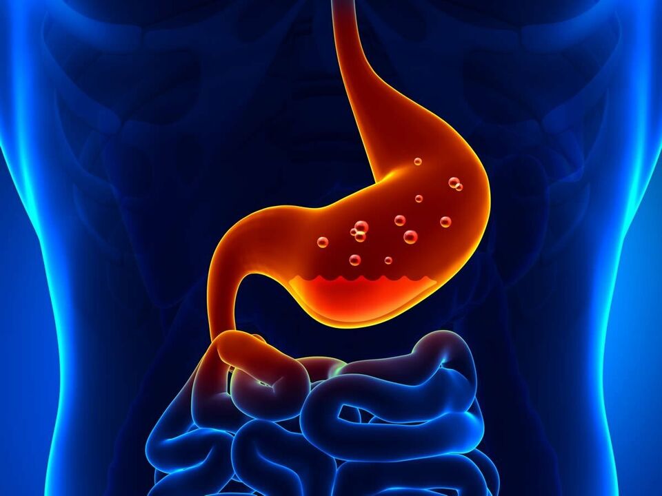 Гастритисот е воспалително заболување на желудникот кое бара исхрана